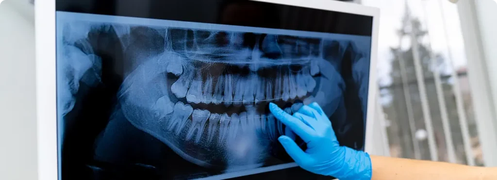 Dental-x-ray-in-dubai